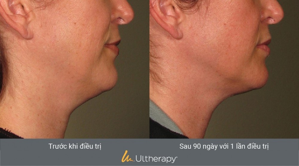 PHÒNG KHÁM DA LIỄU VÀ THẨM MỸ PGS.TS.BS LÊ NGỌC DIỆP