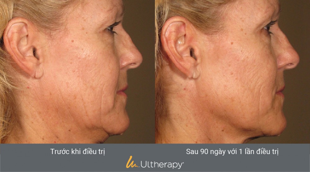 PHÒNG KHÁM DA LIỄU VÀ THẨM MỸ PGS.TS.BS LÊ NGỌC DIỆP