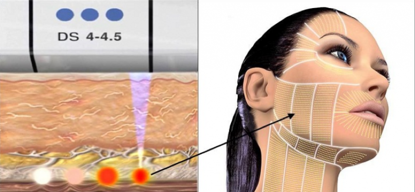 PHÒNG KHÁM DA LIỄU VÀ THẨM MỸ PGS.TS.BS LÊ NGỌC DIỆP