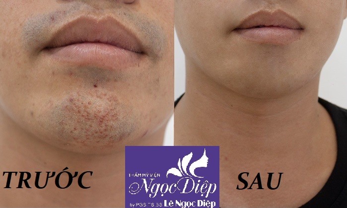 PHÒNG KHÁM DA LIỄU VÀ THẨM MỸ PGS.TS.BS LÊ NGỌC DIỆP