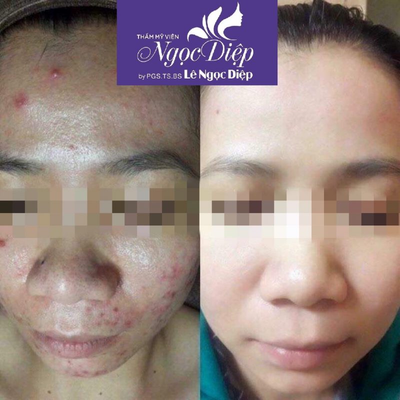 PHÒNG KHÁM DA LIỄU VÀ THẨM MỸ PGS.TS.BS LÊ NGỌC DIỆP