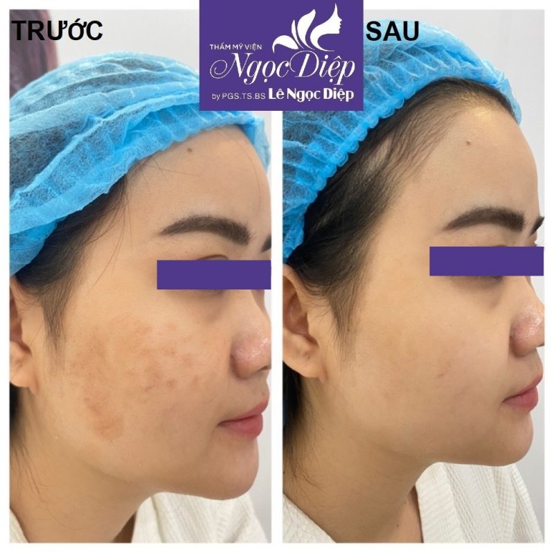 PHÒNG KHÁM DA LIỄU VÀ THẨM MỸ PGS.TS.BS LÊ NGỌC DIỆP