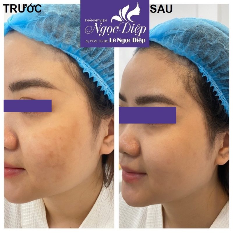 PHÒNG KHÁM DA LIỄU VÀ THẨM MỸ PGS.TS.BS LÊ NGỌC DIỆP