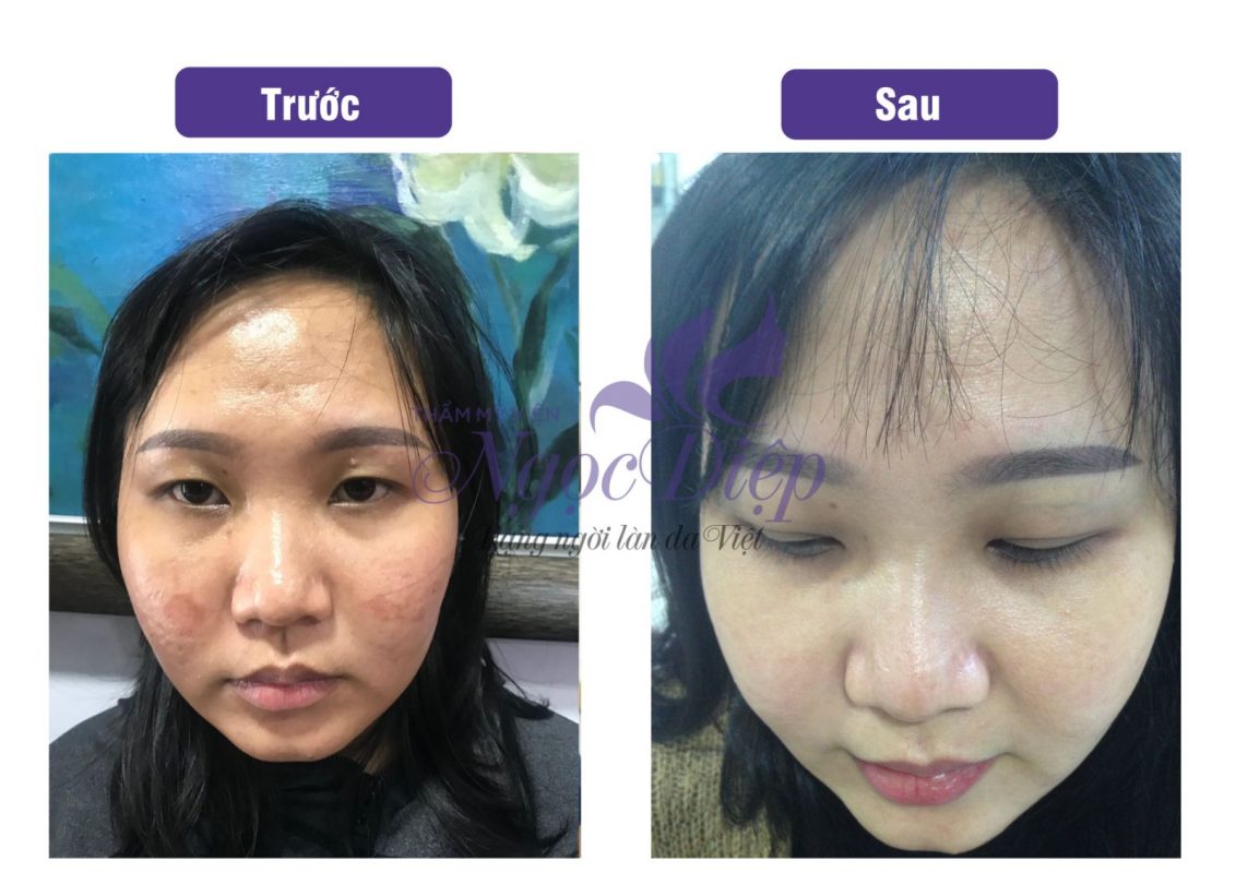 PHÒNG KHÁM DA LIỄU VÀ THẨM MỸ PGS.TS.BS LÊ NGỌC DIỆP