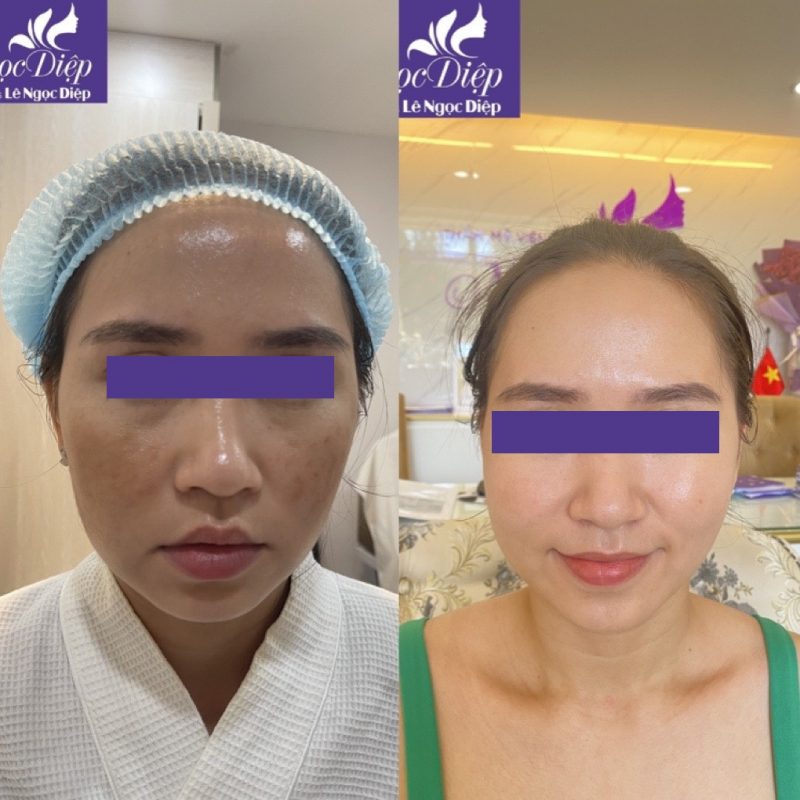 PHÒNG KHÁM DA LIỄU VÀ THẨM MỸ PGS.TS.BS LÊ NGỌC DIỆP
