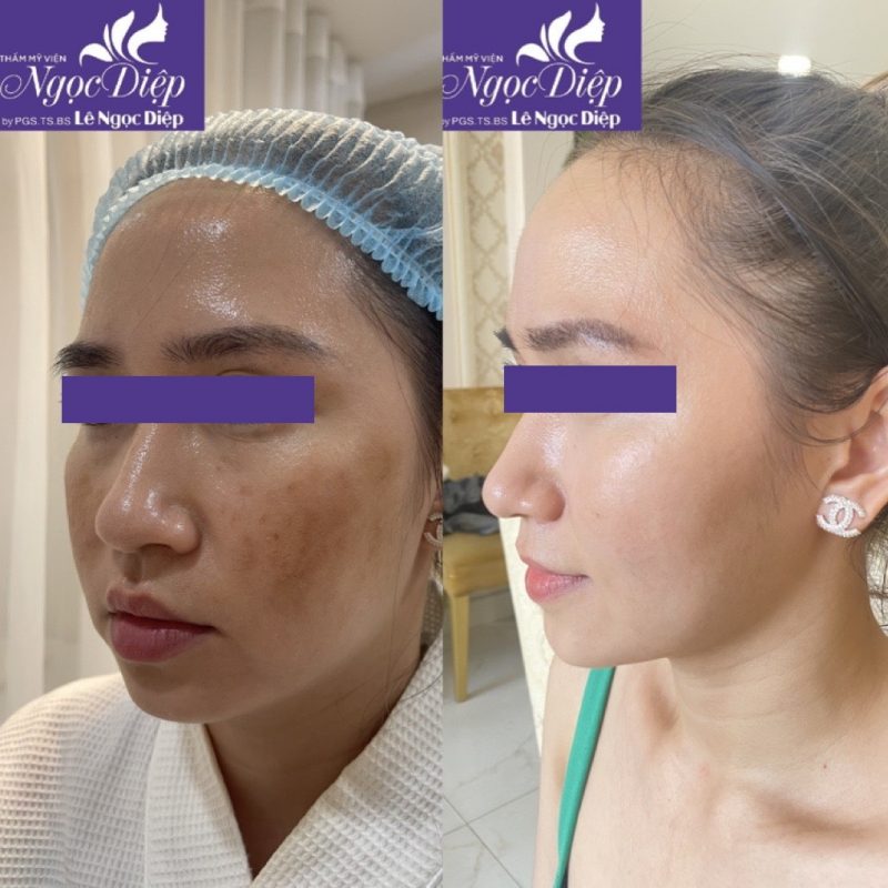 PHÒNG KHÁM DA LIỄU VÀ THẨM MỸ PGS.TS.BS LÊ NGỌC DIỆP
