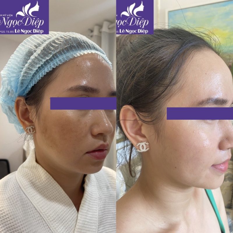 PHÒNG KHÁM DA LIỄU VÀ THẨM MỸ PGS.TS.BS LÊ NGỌC DIỆP