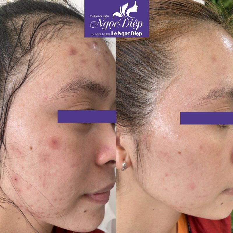 PHÒNG KHÁM DA LIỄU VÀ THẨM MỸ PGS.TS.BS LÊ NGỌC DIỆP