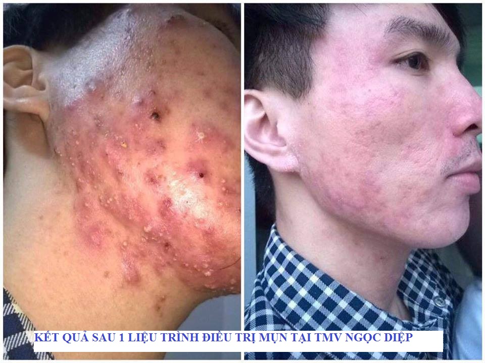 PHÒNG KHÁM DA LIỄU VÀ THẨM MỸ PGS.TS.BS LÊ NGỌC DIỆP