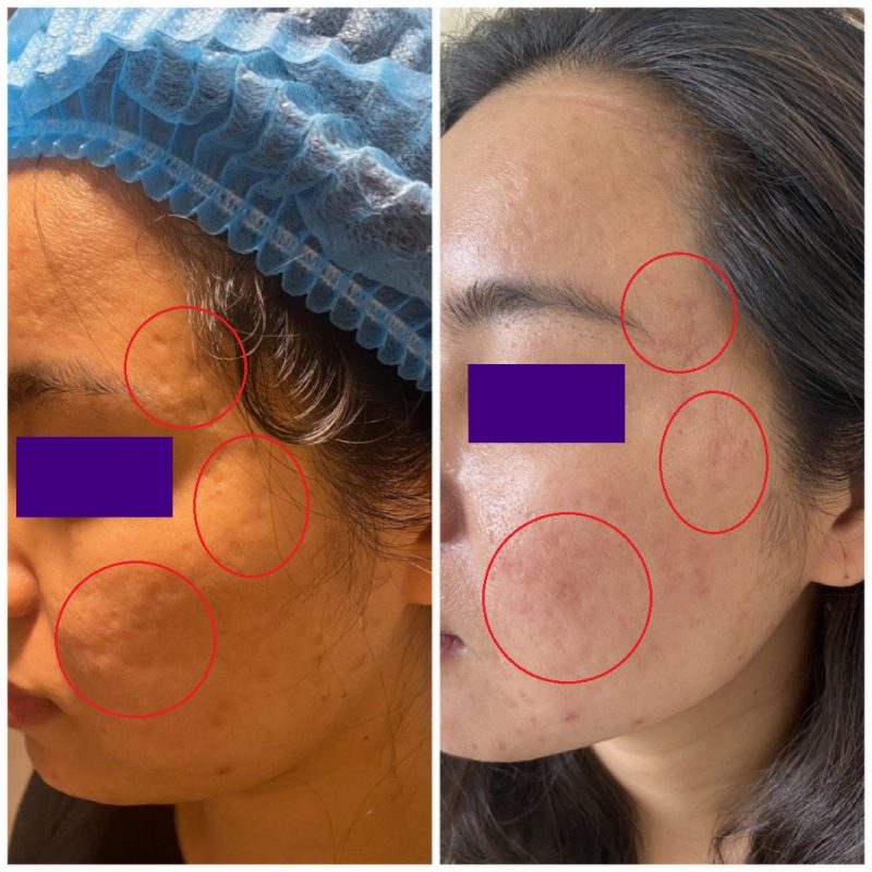 PHÒNG KHÁM DA LIỄU VÀ THẨM MỸ PGS.TS.BS LÊ NGỌC DIỆP