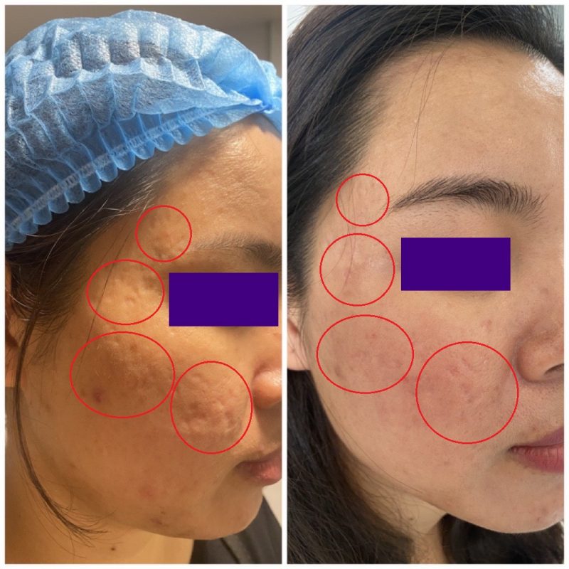 PHÒNG KHÁM DA LIỄU VÀ THẨM MỸ PGS.TS.BS LÊ NGỌC DIỆP
