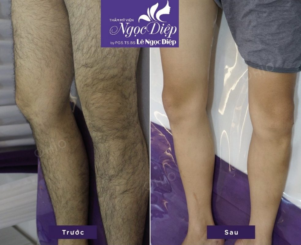 PHÒNG KHÁM DA LIỄU VÀ THẨM MỸ PGS.TS.BS LÊ NGỌC DIỆP