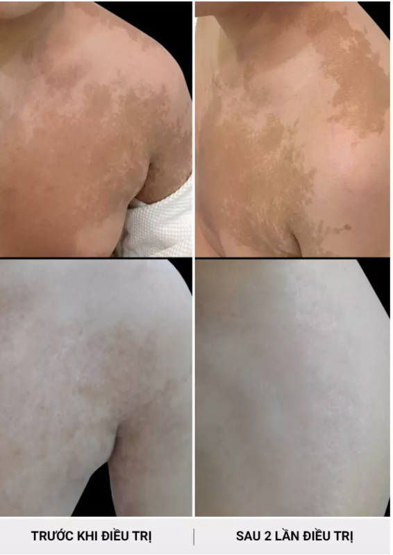 PHÒNG KHÁM DA LIỄU VÀ THẨM MỸ PGS.TS.BS LÊ NGỌC DIỆP