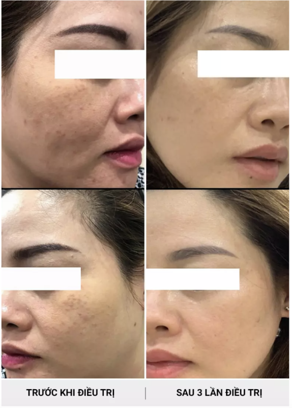 PHÒNG KHÁM DA LIỄU VÀ THẨM MỸ PGS.TS.BS LÊ NGỌC DIỆP