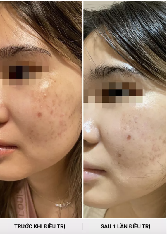 PHÒNG KHÁM DA LIỄU VÀ THẨM MỸ PGS.TS.BS LÊ NGỌC DIỆP