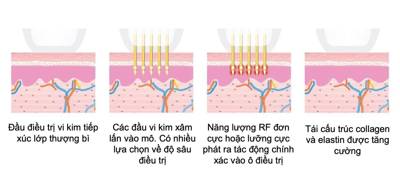 PHÒNG KHÁM DA LIỄU VÀ THẨM MỸ PGS.TS.BS LÊ NGỌC DIỆP