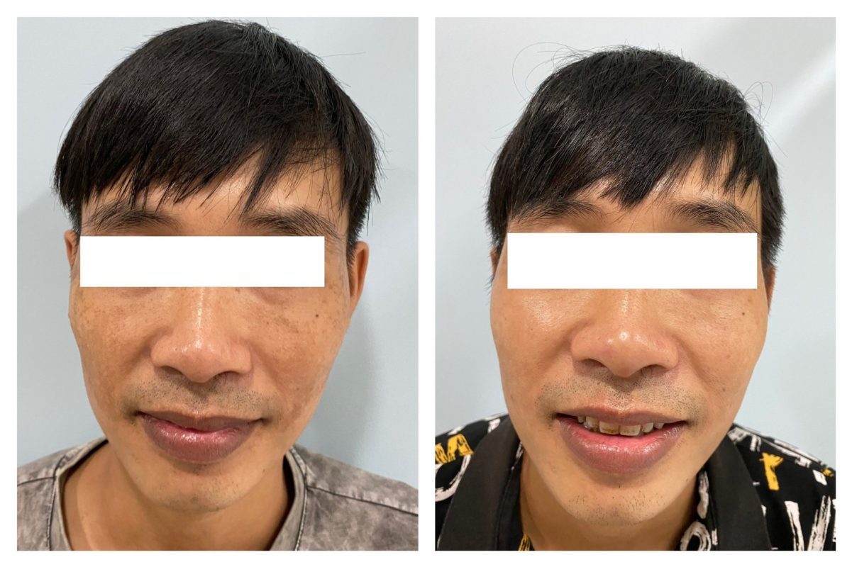 PHÒNG KHÁM DA LIỄU VÀ THẨM MỸ PGS.TS.BS LÊ NGỌC DIỆP