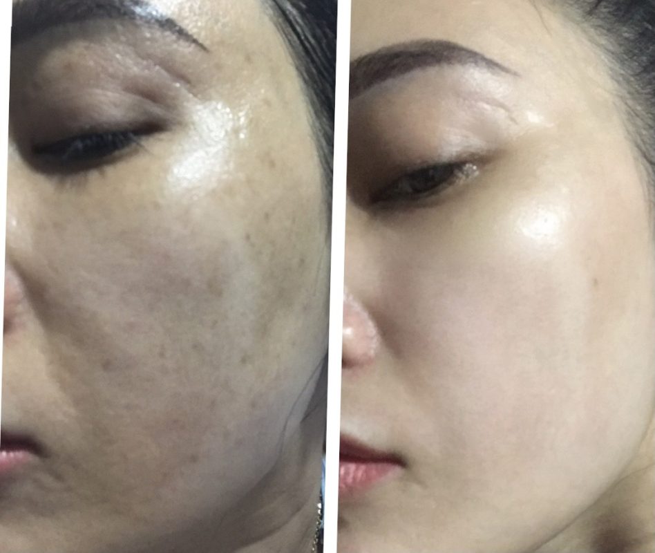 PHÒNG KHÁM DA LIỄU VÀ THẨM MỸ PGS.TS.BS LÊ NGỌC DIỆP