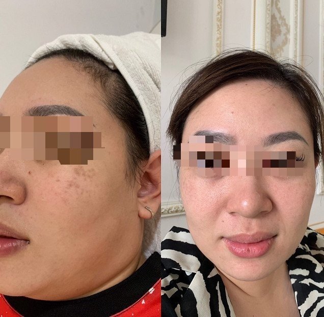 PHÒNG KHÁM DA LIỄU VÀ THẨM MỸ PGS.TS.BS LÊ NGỌC DIỆP