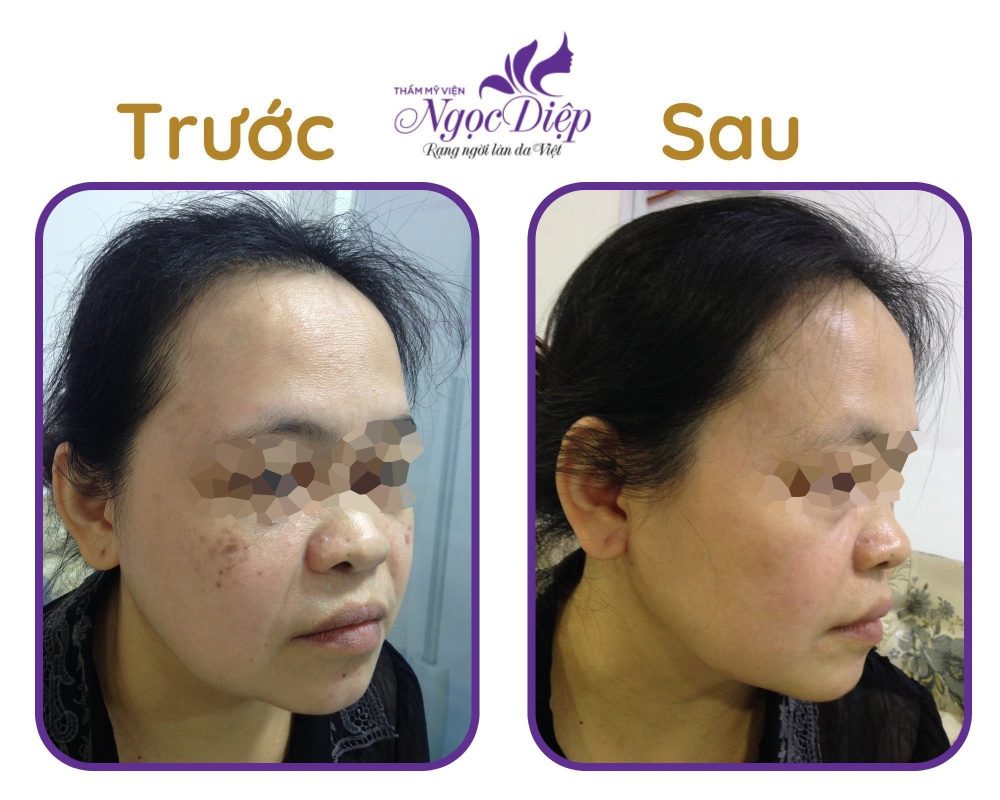 PHÒNG KHÁM DA LIỄU VÀ THẨM MỸ PGS.TS.BS LÊ NGỌC DIỆP