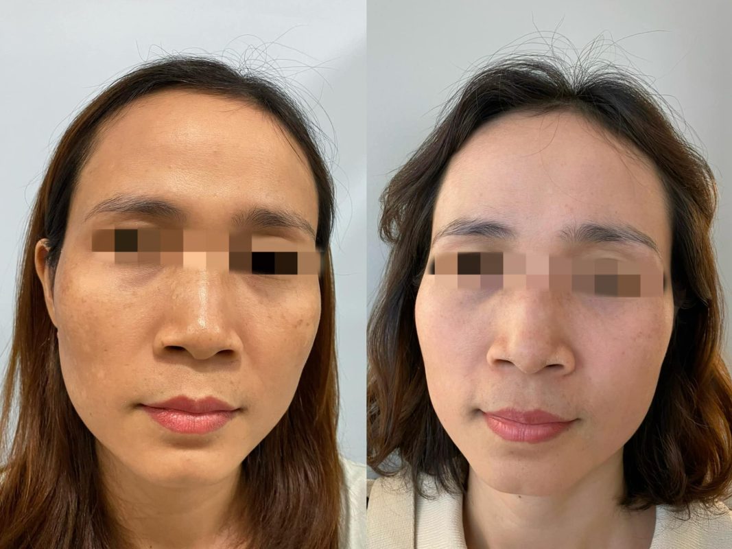 PHÒNG KHÁM DA LIỄU VÀ THẨM MỸ PGS.TS.BS LÊ NGỌC DIỆP