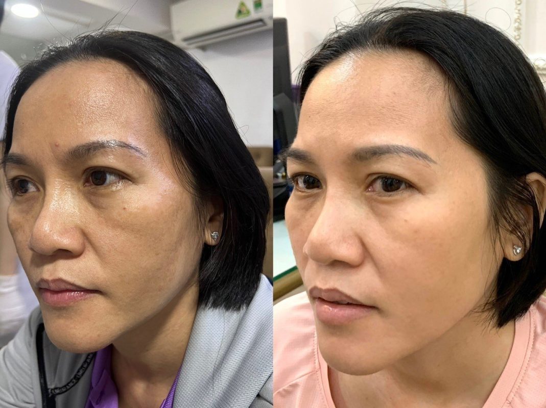 PHÒNG KHÁM DA LIỄU VÀ THẨM MỸ PGS.TS.BS LÊ NGỌC DIỆP