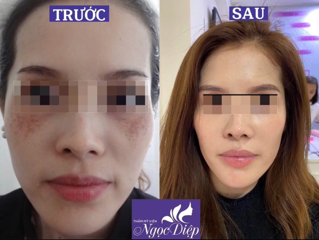 PHÒNG KHÁM DA LIỄU VÀ THẨM MỸ PGS.TS.BS LÊ NGỌC DIỆP